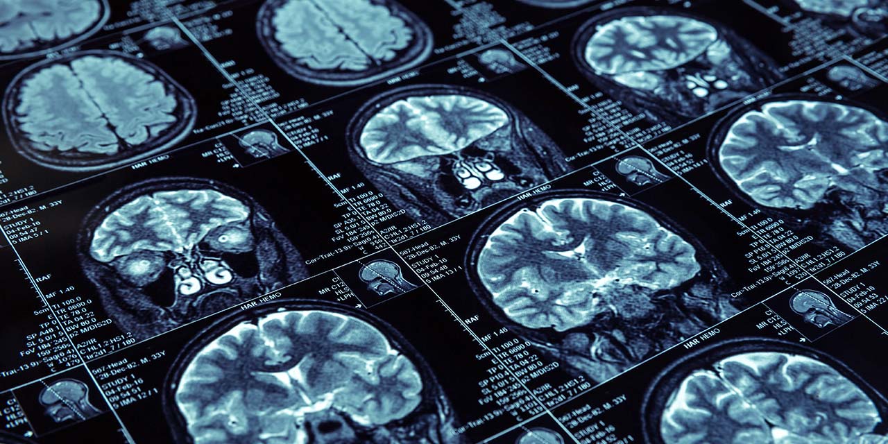 [Etude] Impact de la réflexologie plantaire sur l&rsquo;activité cérébrale